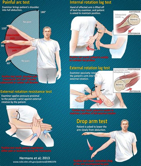 test for rotator cuff tears|positive rotator cuff test.